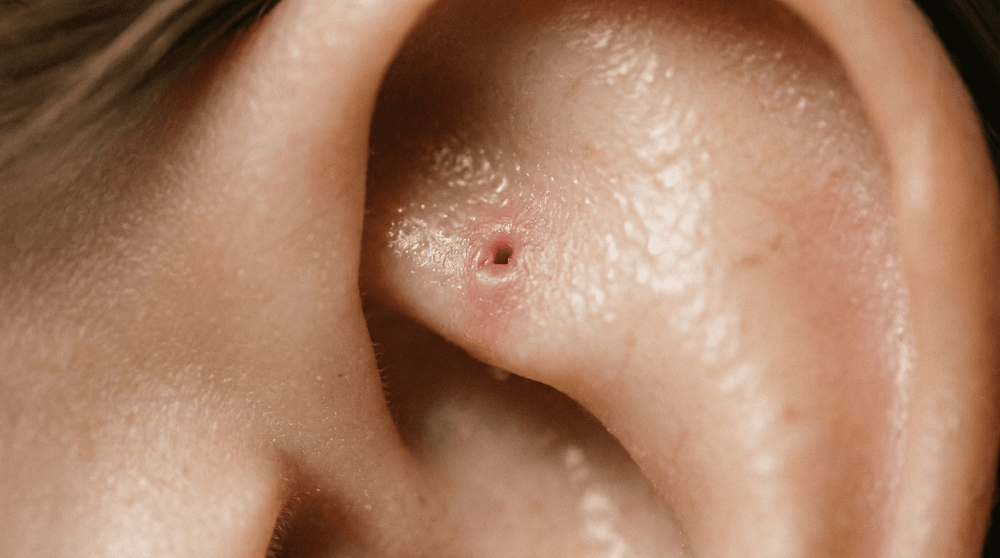 Rook Piercing Healing Time: What to Expect and How to Help It Heal