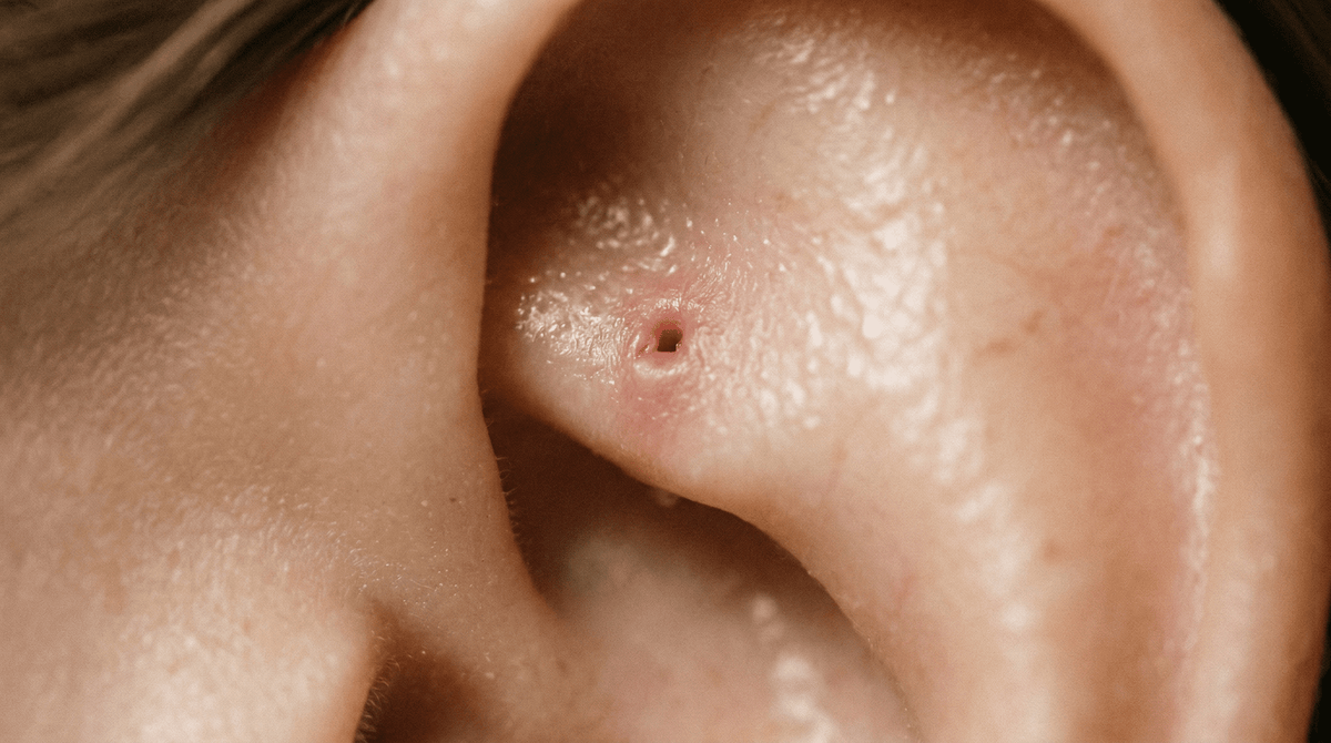 Rook Piercing Healing Time: What to Expect and How to Help It Heal