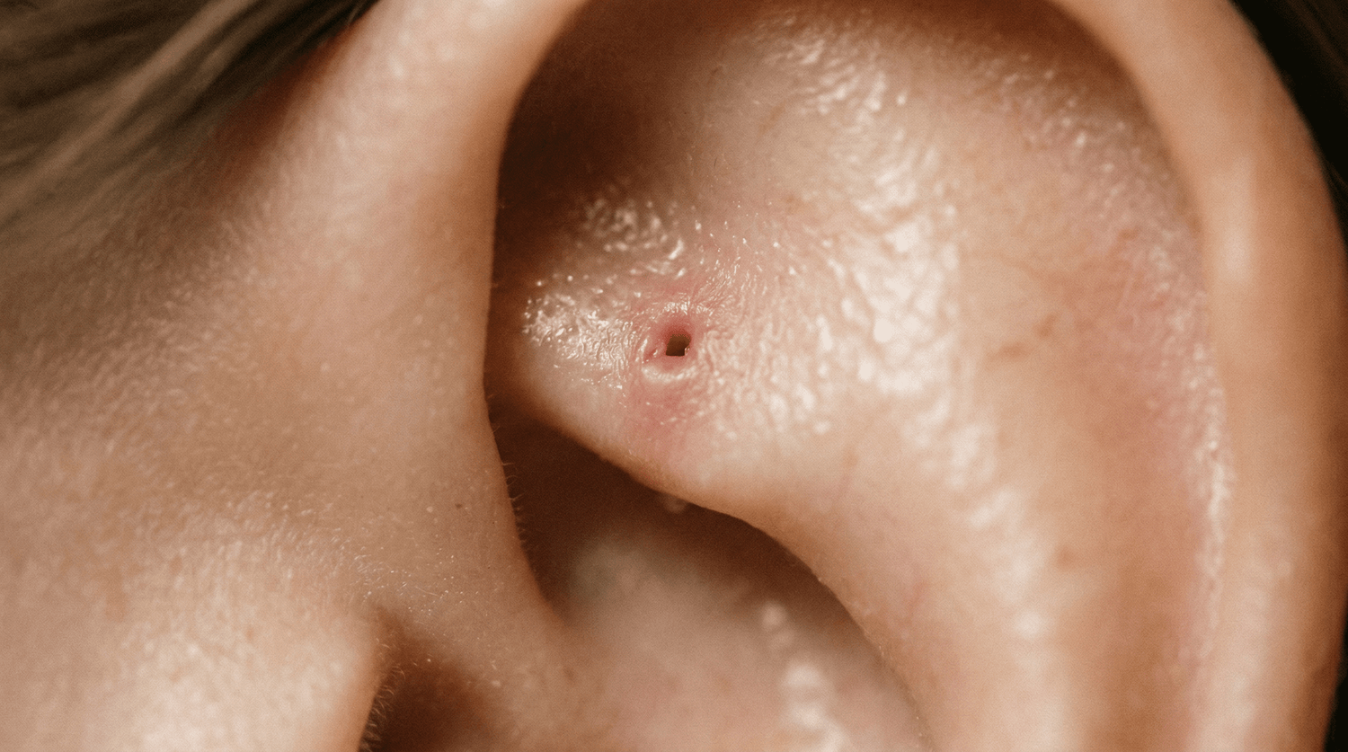 Rook Piercing Healing Time: What to Expect and How to Help It Heal - rhokea